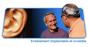 Un implant révolutionnaire pour pallier à la surdité des personnes âgées - Source de l'image : http://www.envoymedical.fr