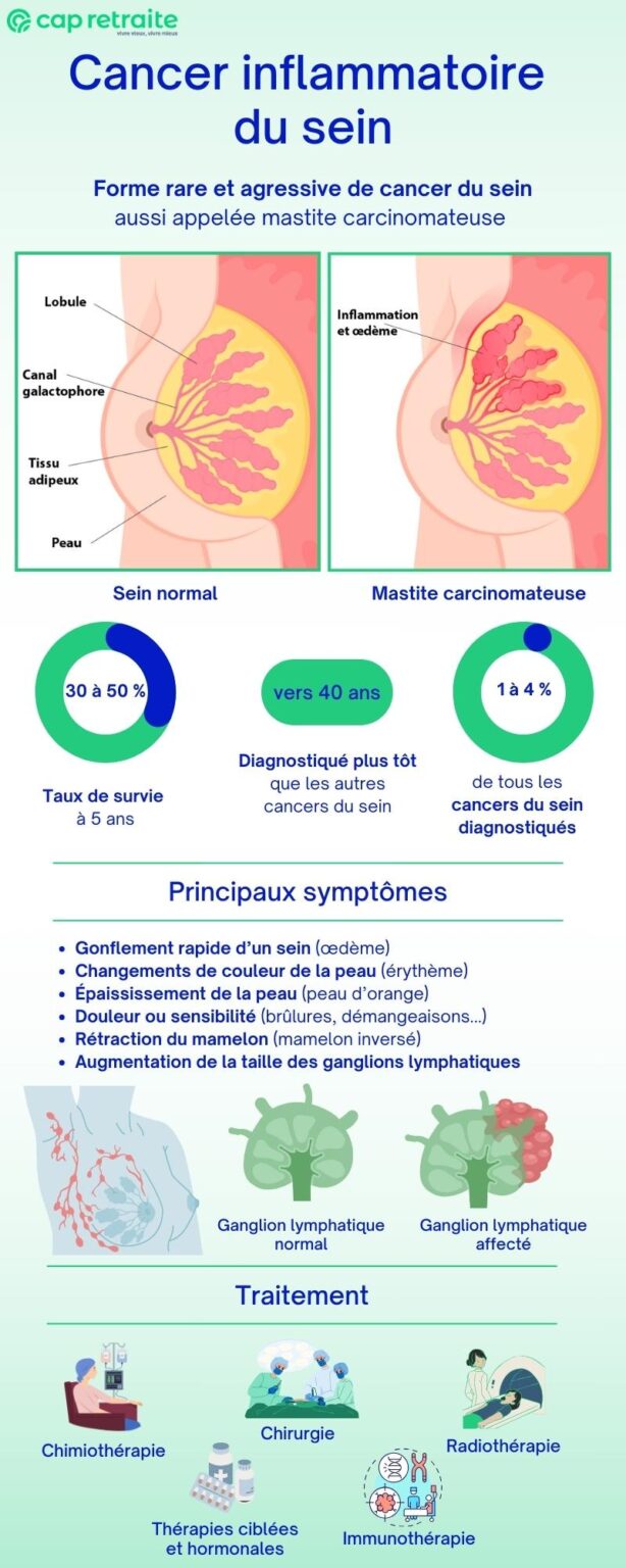 Le cancer inflammatoire du sein : diagnostic et traitement