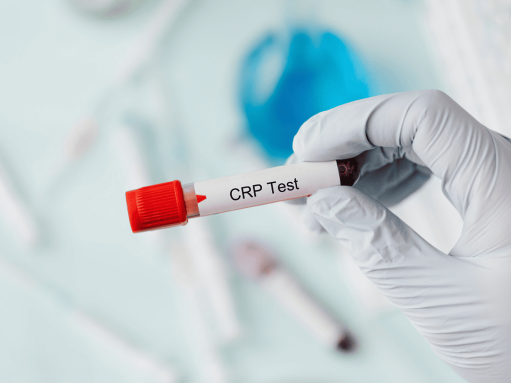 Test CRP