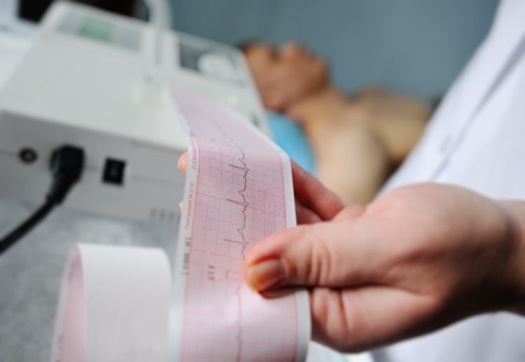 Homme passant un ECG pour diagnostiquer une arythmie cardiaque