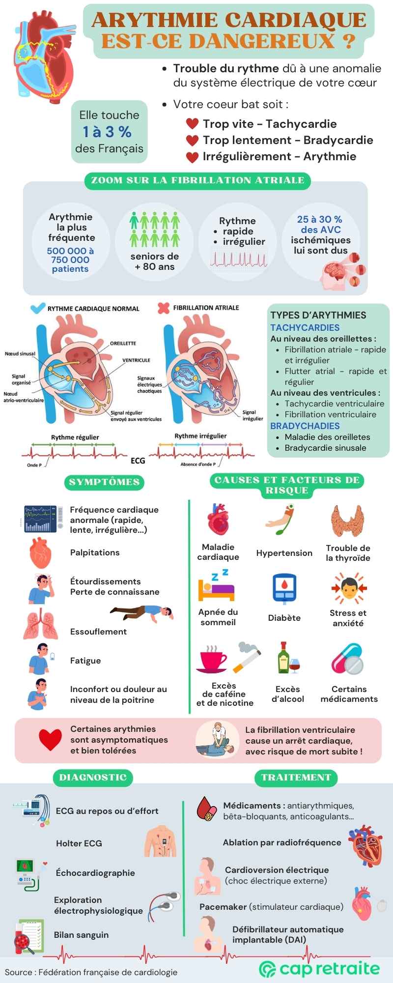 Infographie sur l'arythmie cardiaque : symptômes, causes, diagnostic et traitement