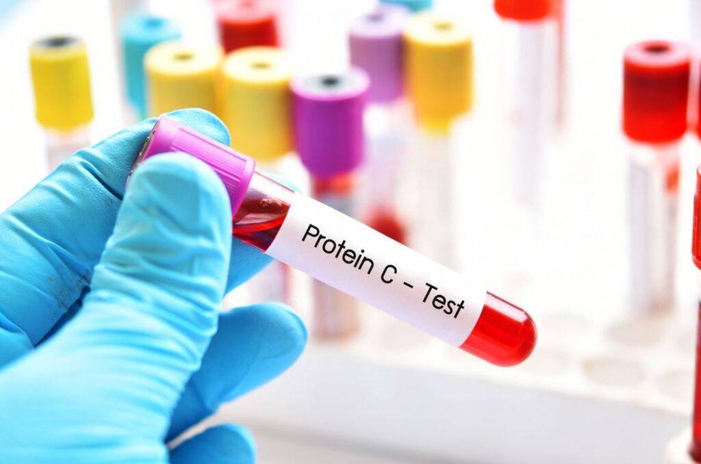 Analyse du taux de Protéine C réactive