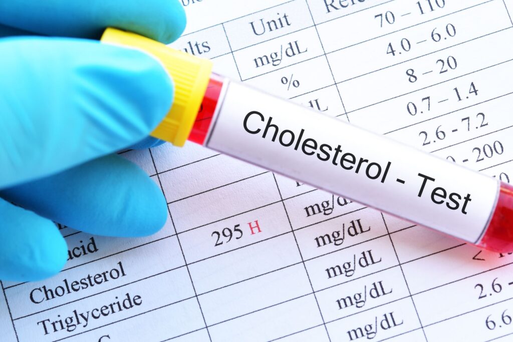 test de cholesterol et de triglycérides