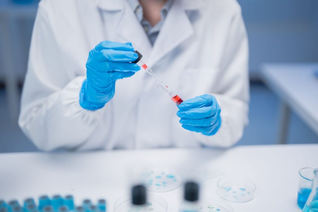 analyse dans un laboratoire lyonnais sur une molécule prometteuse contre la maladie de Charcot