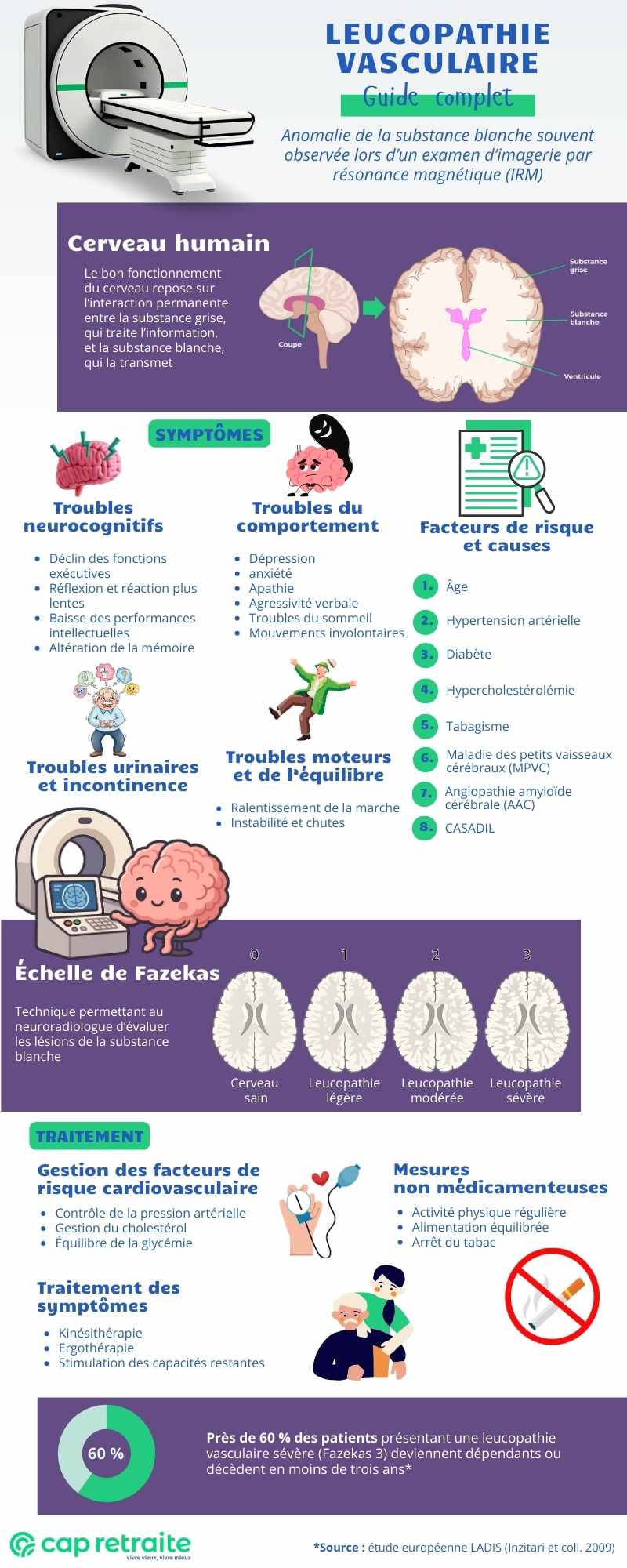 Infographie présentant la leucopathie vasculaire Fazekas 1, 2 ou 3 : causes, symptômes, traitement et espérance de vie